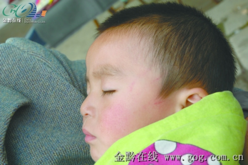 幼儿园女老师扇两岁半幼儿耳光称心情不好(图)